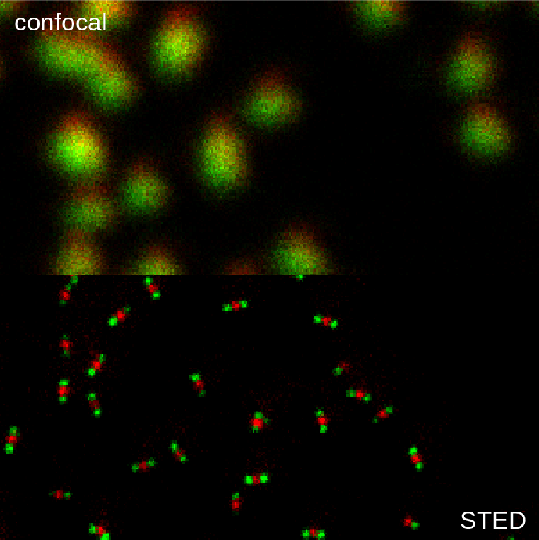 Confocal vs STED