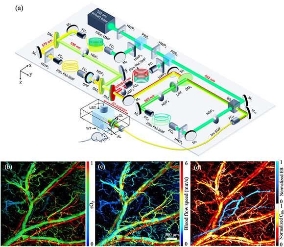 Optical-Resolution Photoacoustic Microscopy Innovation for Simultaneous Multicontrast Imaging