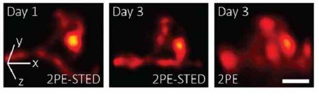Researchers Capture First 3D Super-Resolution Images in Living Mice